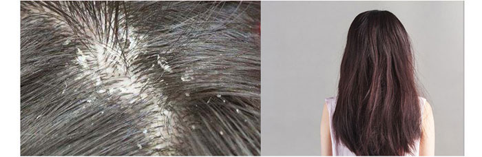 ���ϼ���-�Ř�ɽ����ϴ�l(f��)��